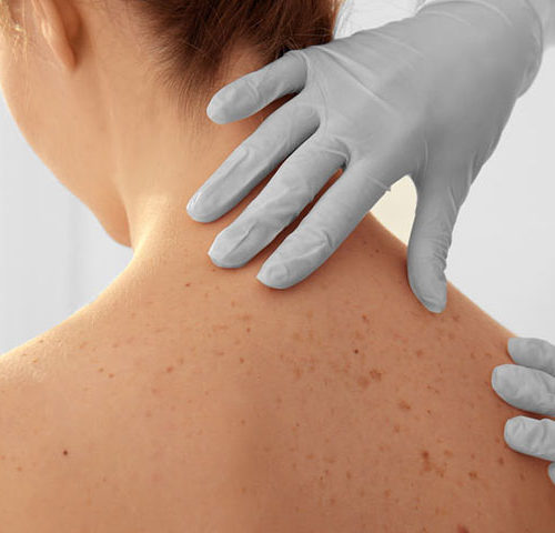 Dermatologia