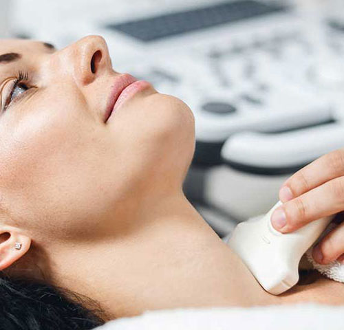 Ultrassom de Carótidas e Vertebrais