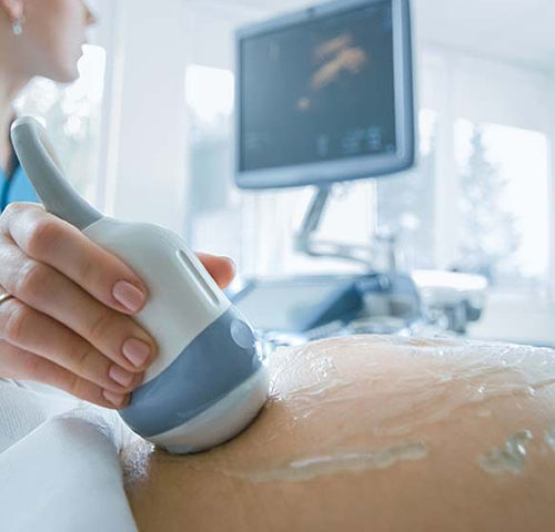 Ecodopplercardiograma Fetal