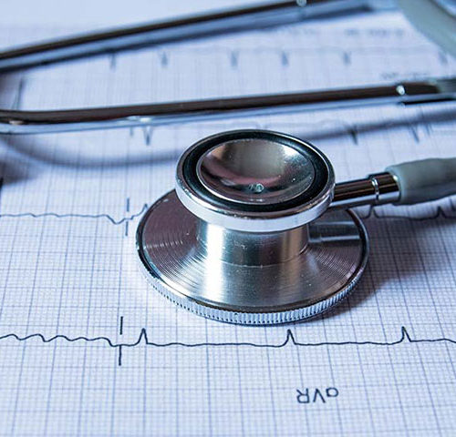 Eletrocardiograma – ECG