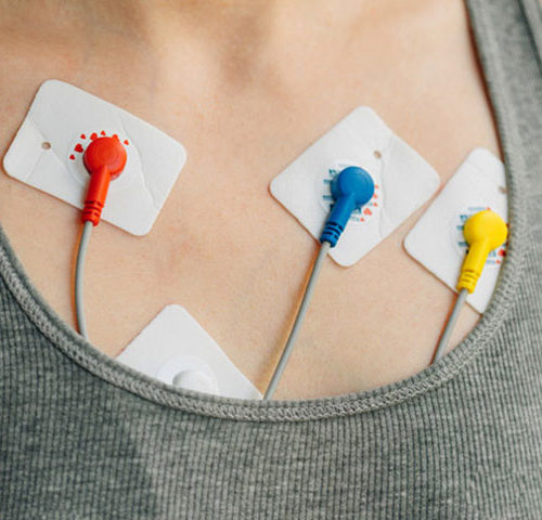 HOLTER – Sistema HOLTER 24h – 3 Canais – Digital