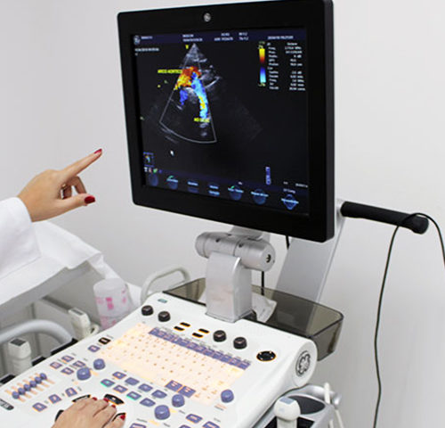 Ecodopplercardiograma Transtorácico