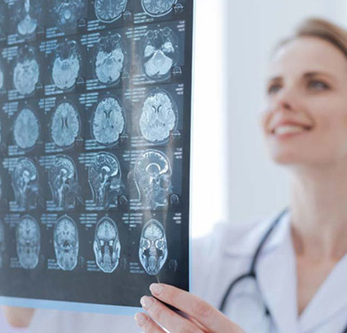 Neurologia