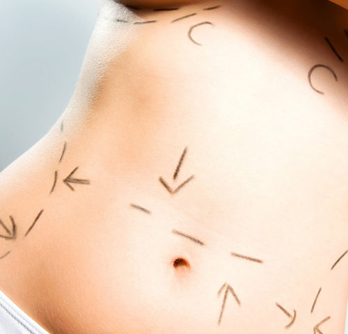 Cirurgia Plástica